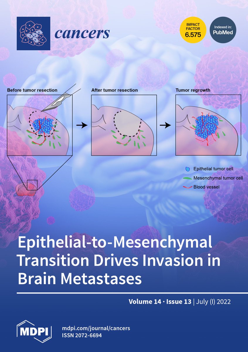 Andreia's EMT work made it to the cover of the July issue of Cancers! 🧠🔬 Congrats! 😃

mdpi.com/2072-6694/14/13