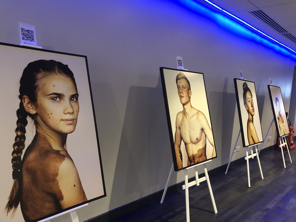 IrenyIskandar's tweet photo. When art, photography and creativity is combined with dermatology @HealthySkin4All #BAD2022  #CMN  #HowdoyouCMeNow         https://t.co/q9eCBJWShY https://t.co/OJKLRUVdcH
