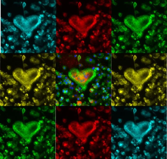FlaminGoH2020's tweet photo. "Heart Shaped Bones":
A fluorescence image of an osteoclast, a bone resorbing cell, shaped like a heart, turned into a colorful mosaic".
#congratulations to Ana Carolina Monteiro form the i3s, Portugal, for the #2prize in the #photocontest "The beauty of #biomedicine" https://t.co/6brpi1sMtt