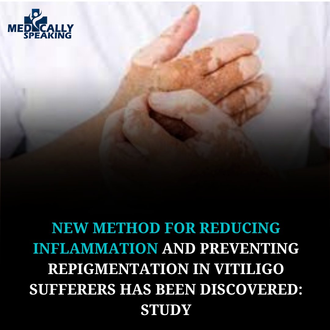 medspeakingitv's tweet image. medicallyspeaking.in/Medical News...
#vitiligo #inflamation #repigmentation
Follow @medspeakingitv for more