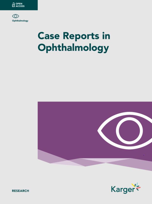 A Case of Birdshot Chorioretinopathy following Varicella Zoster Virus-Induced Progressive #RetinalNecrosis in the Contralateral #Eye

✍ Atsuki Fukushima et al. 
📖 Case Reports in Ophthalmology
🔗️ karger.com/Article/FullTe…

#ophthalmology