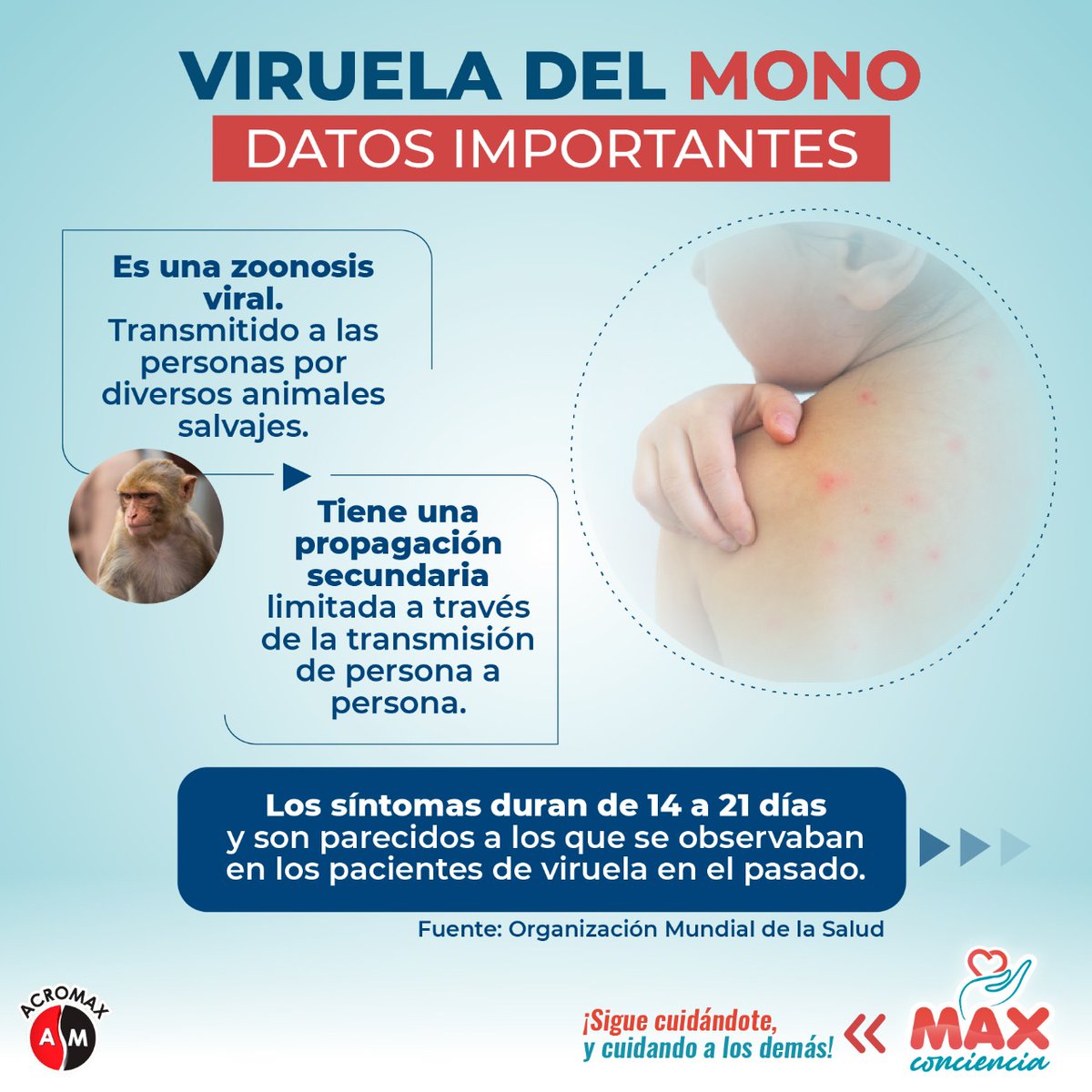 AcromaxEcuador's tweet photo. 📍La viruela del mono, una enfermedad inusual que también es conocida como #monkeypox.
🔸️Es importante estar alerta ante cualquier síntoma y consultar con un médico.🔸️
#MaxConciencia
#OMS #viruela #virueladelmono #virus #viruelasimica #salud #Termax #Dolor https://t.co/44MQbQvi1g