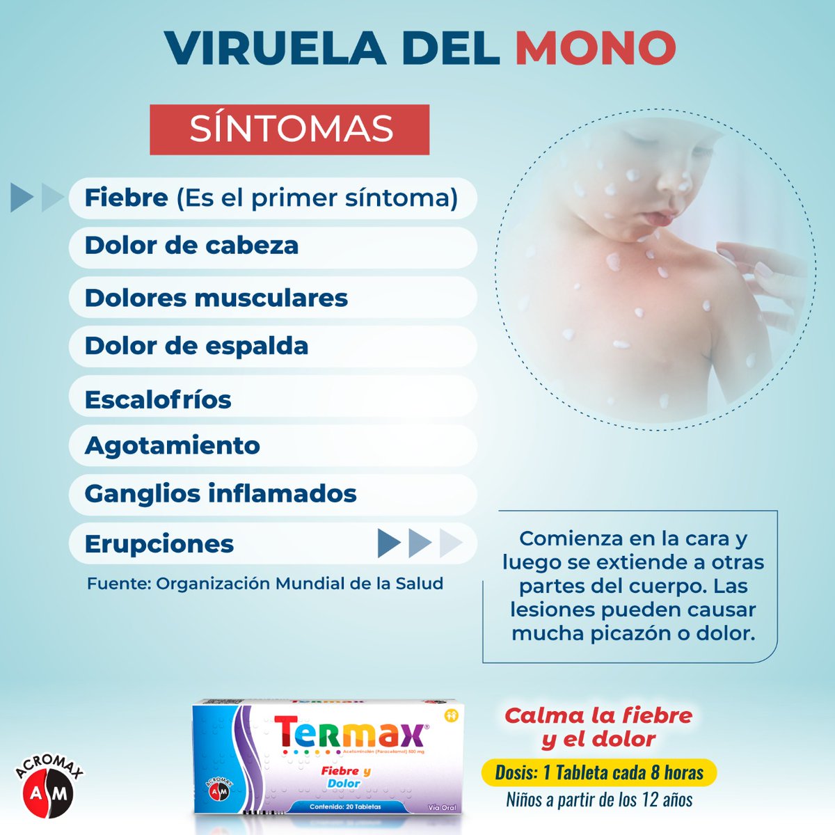 AcromaxEcuador's tweet photo. 📍La viruela del mono, una enfermedad inusual que también es conocida como #monkeypox.
🔸️Es importante estar alerta ante cualquier síntoma y consultar con un médico.🔸️
#MaxConciencia
#OMS #viruela #virueladelmono #virus #viruelasimica #salud #Termax #Dolor https://t.co/44MQbQvi1g