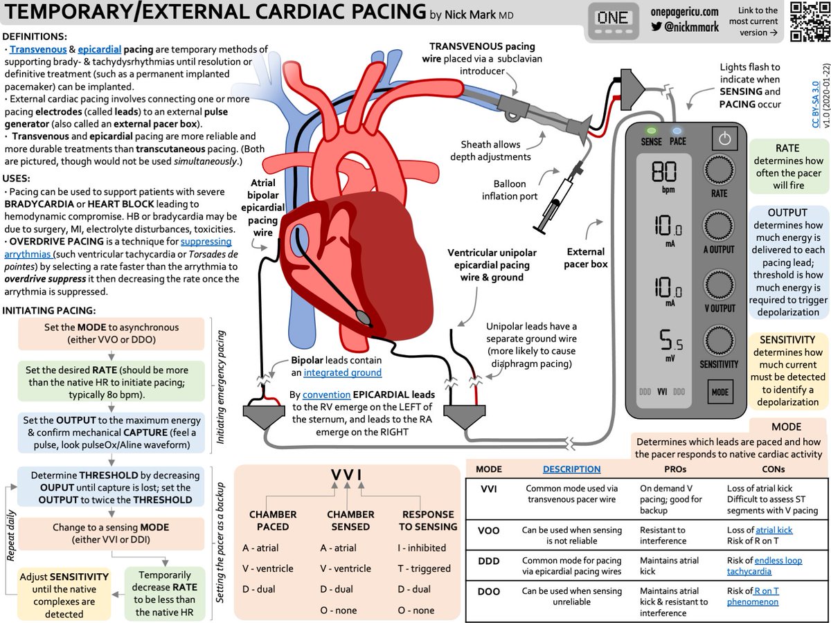 Today's ICU #OnePager is transvenous &amp; epicardial #pacing⚡️

Where do the leads go? What's bipolar vs unipolar? How does the pacer box work? What are the modes (e.g. VVI, DOO, etc)? How do you adjust the settings? 

Learn all about these important devices:
onepagericu.com/transvenous-ep…