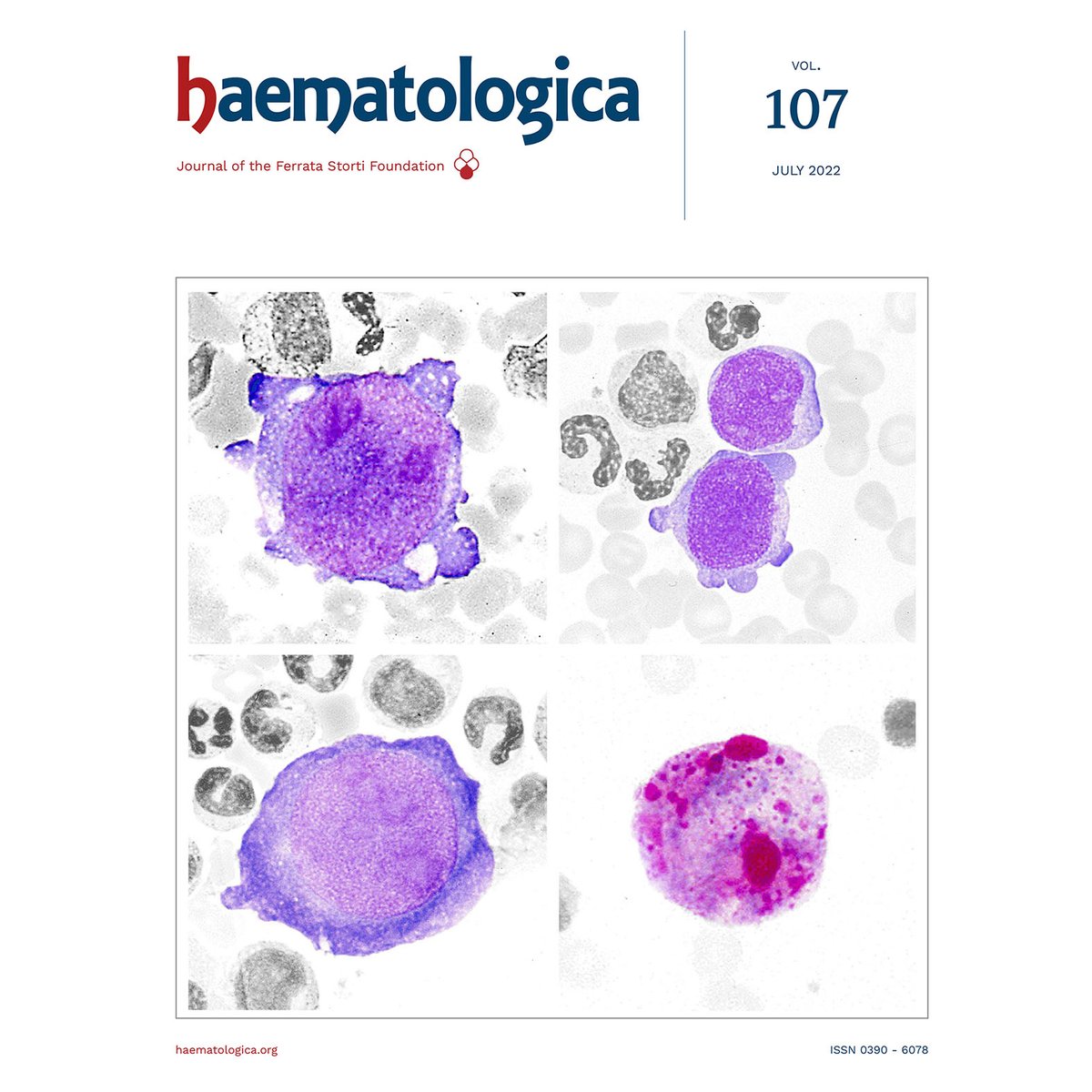 CARDINAL study 1-year interim follow-up results reinforce the positive risk-benefit profile of sutimlimab as an effective long-term therapy with an acceptable safety profile for management of patients with chronic CAD.
haematologica.org/article/view/h…