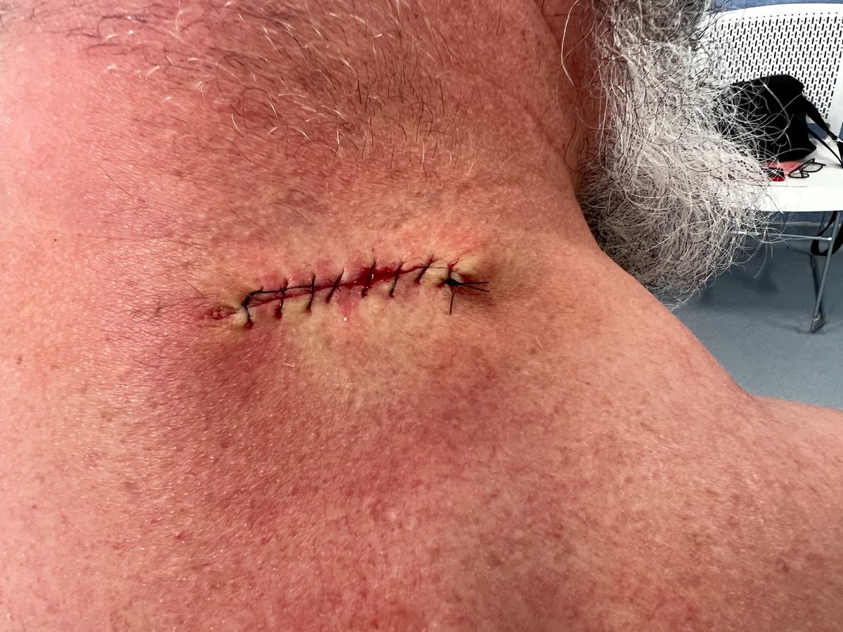 netropolis's tweet image. 2022 stitch count... 53