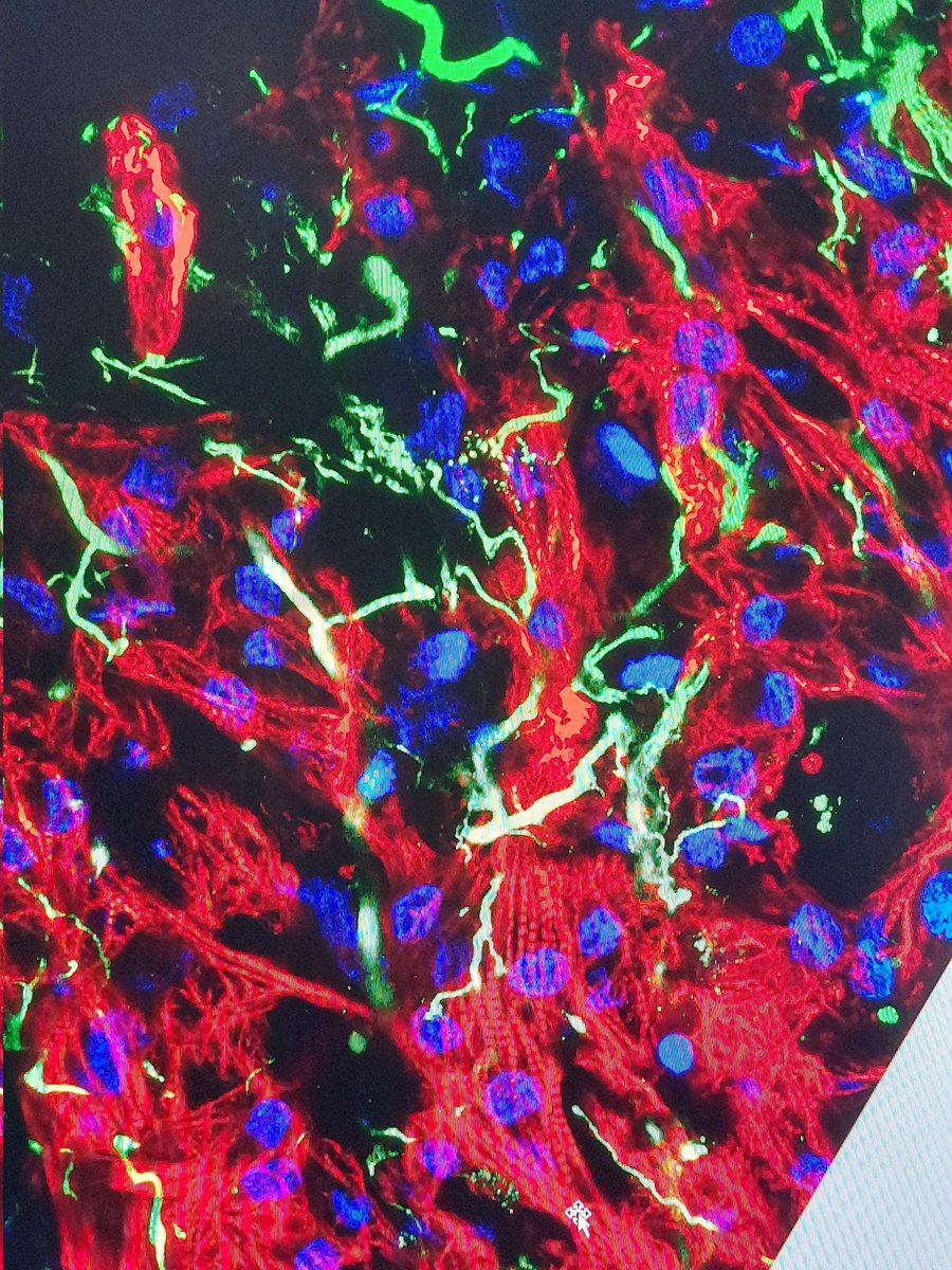 MariaPatapia's tweet photo. Are u interested in studying #neurocardiac interactions? We are a looking for motivated phd candidates to study neurocardiomyocyte crosstalk in a human #ipsc derived innervated #cardiacmuscle. Previous expertise in #tissueengineering and ipsc are welcome. Interested?send me a DM https://t.co/vDT6xcOGhl