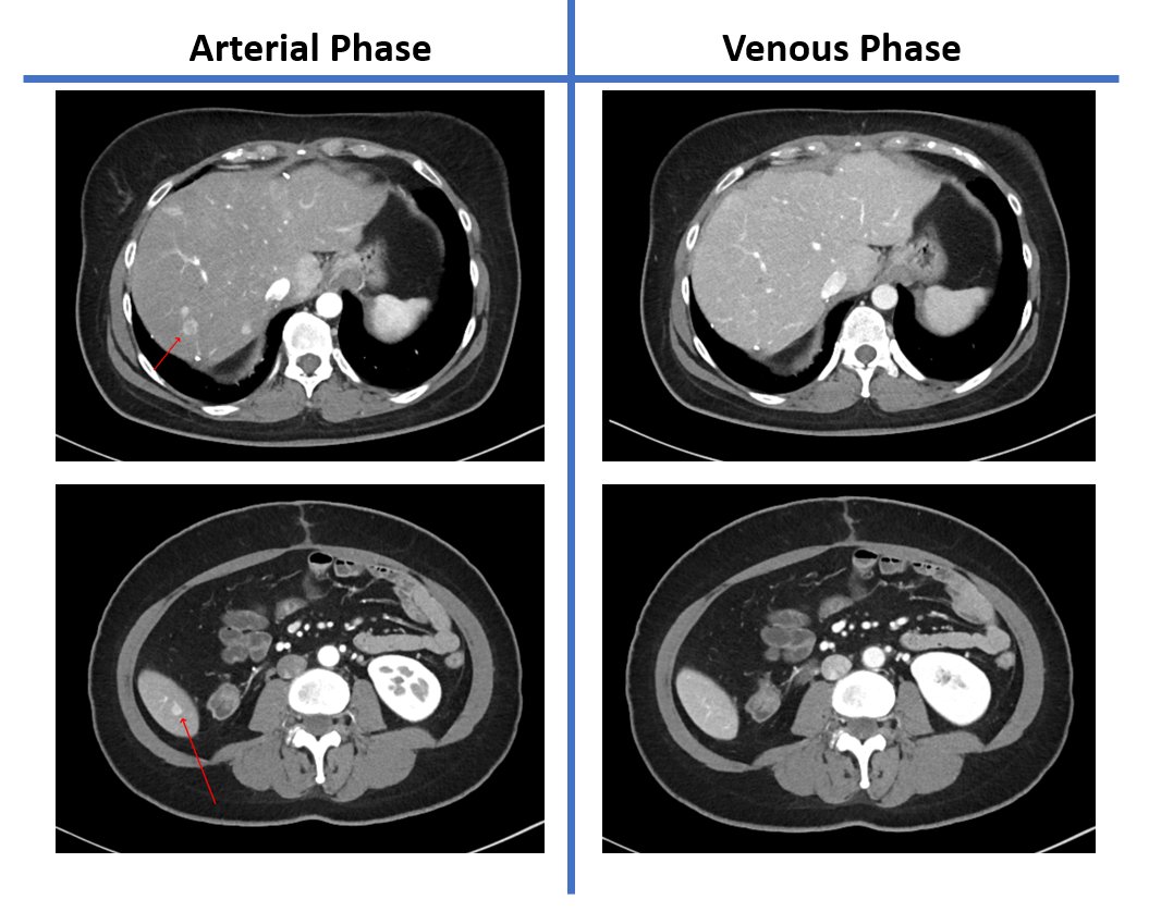 Thor Halfdanarson tweet media