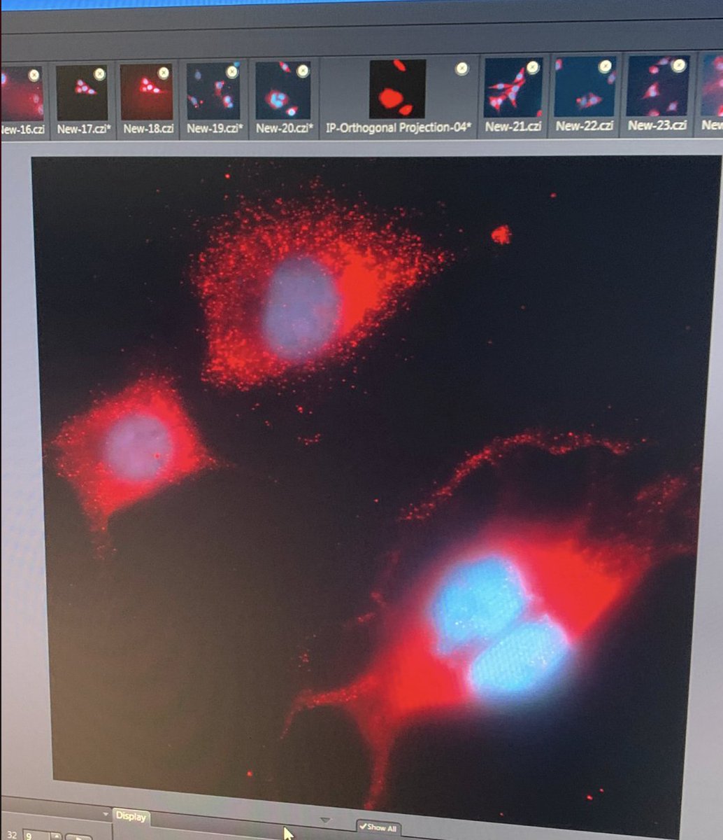 Arjun Raj (@arjunrajlab) on Twitter photo And the winner of best RNA FISH spots at Single Cell Analysis 2022 <a href="/cshlcourses/">CSHL Courses</a> module led by <a href="/DylanLSchaff/">Dylan Schaff</a> and <a href="/sydshaffer/">Sydney Shaffer</a> is⦠<a href="/neurosheed/">Sheed Itaman</a>, who "caught a fish with FISH"! And nice spots, too! And the winner of best RNA FISH spots at Single Cell Analysis 2022 <a href="/cshlcourses/">CSHL Courses</a> module led by <a href="/DylanLSchaff/">Dylan Schaff</a> and <a href="/sydshaffer/">Sydney Shaffer</a> is⦠<a href="/neurosheed/">Sheed Itaman</a>, who "caught a fish with FISH"! And nice spots, too!