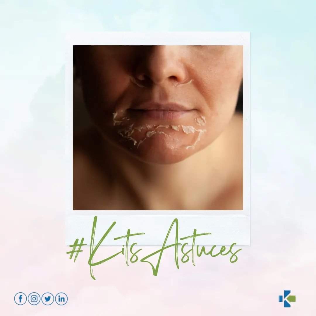 KitPharma's tweet photo. | La Kit's astuce| 

Avez-vous déjà entendu parler du peeling? Il s’agit d’une technique médicale consistant à éliminer la couche supérieure de l'épiderme de manière à éliminer les peaux mortes, mais aussi les taches, les imperfections, les rides et ridules. 
.
.
.
.
.
.
.
.
. 
. https://t.co/UIiibhtY6C