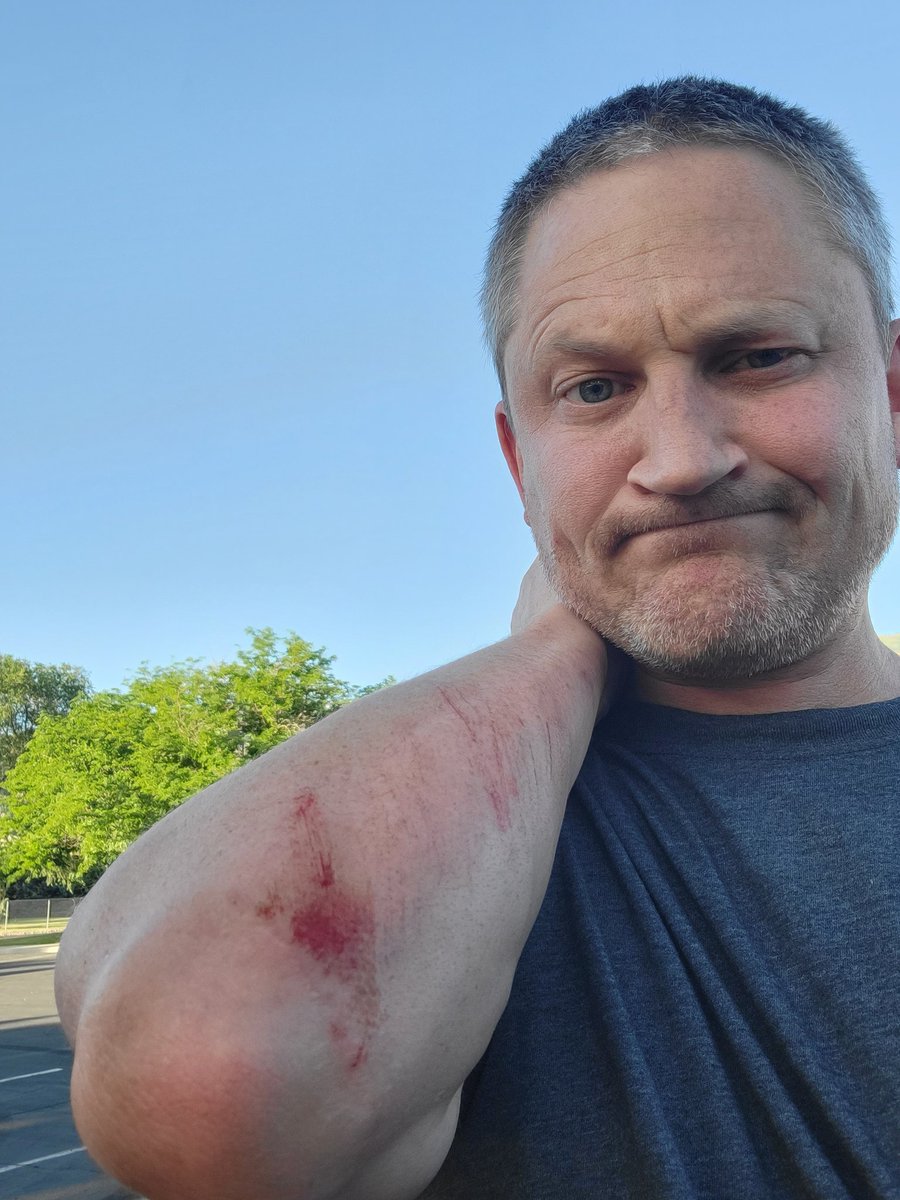 2foot__'s tweet photo. @brics_nft Went mountain biking. Have not been for 22 years. If you are not wiping out you are not trying. Hahaha #nfts #solananfts #solnft #ethnfts #nftcommunity
#GETPUTSIDE https://t.co/kZPhAmvgI1