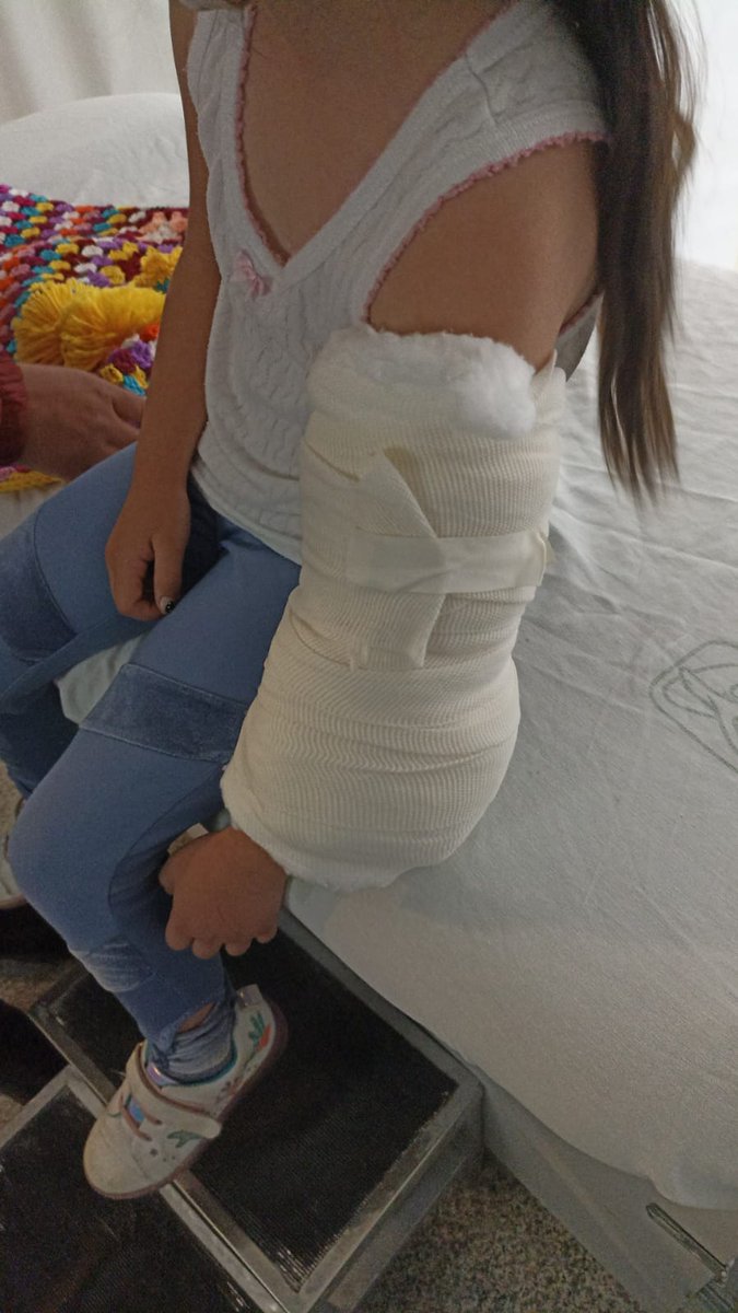 OscarChavez91's tweet photo. Razón #331 por la cual los internos deben de rotar por TYO.  
Para que no lleguen al servicio sin saber cómo poner una 🤬 férula!!! 😒 https://t.co/dwZpXDVC8k