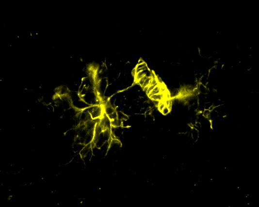 Jake_Cashion_'s tweet photo. Thought I'd hop on the #FluorescenceFriday train. Here's an astrocyte enwrapping itself around a blood vessel ✨🩸 https://t.co/MCZNCkyAAn