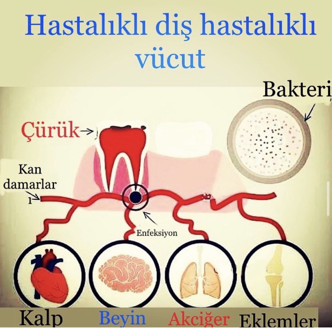Ağız içindeki problemler, tedavi edilmez ise, tedaviye dirençli uzak bölgelerde hastalığa neden olurlar!
Bel , boyun , baş ağrısı gibi.