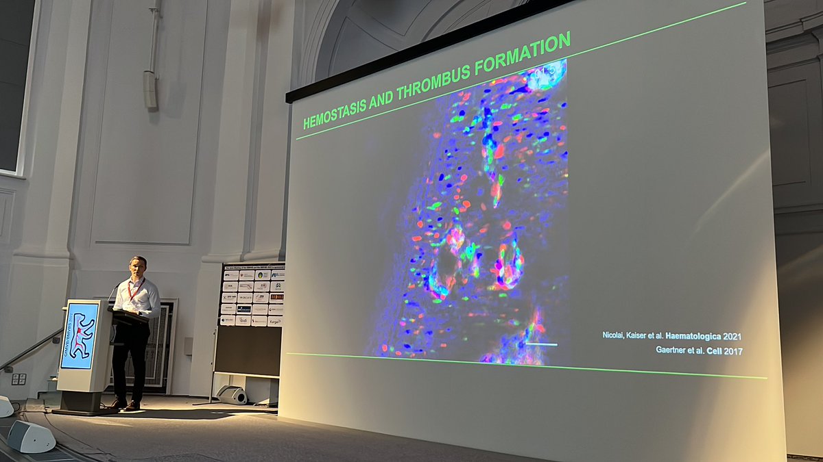 dean_kavanagh's tweet photo. Platelets aren’t bad guys - that’s how you open a talk about platelets, get the audience on side 😂
@kaisersohn showing some cool data and great images - platelets are crucial in limiting inflammatory haemorrhage and get primed by inflammation for coagulation @BMVBSoc https://t.co/fesZuE3T9c