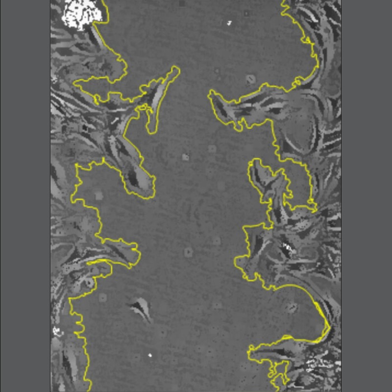 LeicaMicro's tweet photo. π° Read this #article to find out how wound healing of cultured smooth muscle cells (SMCs) in #multiwell plates can be investigated with less effort and reliably over time using a specially configured #DMi8 S inverted #microscope and on-stage #incubator.
β
Learn more!
