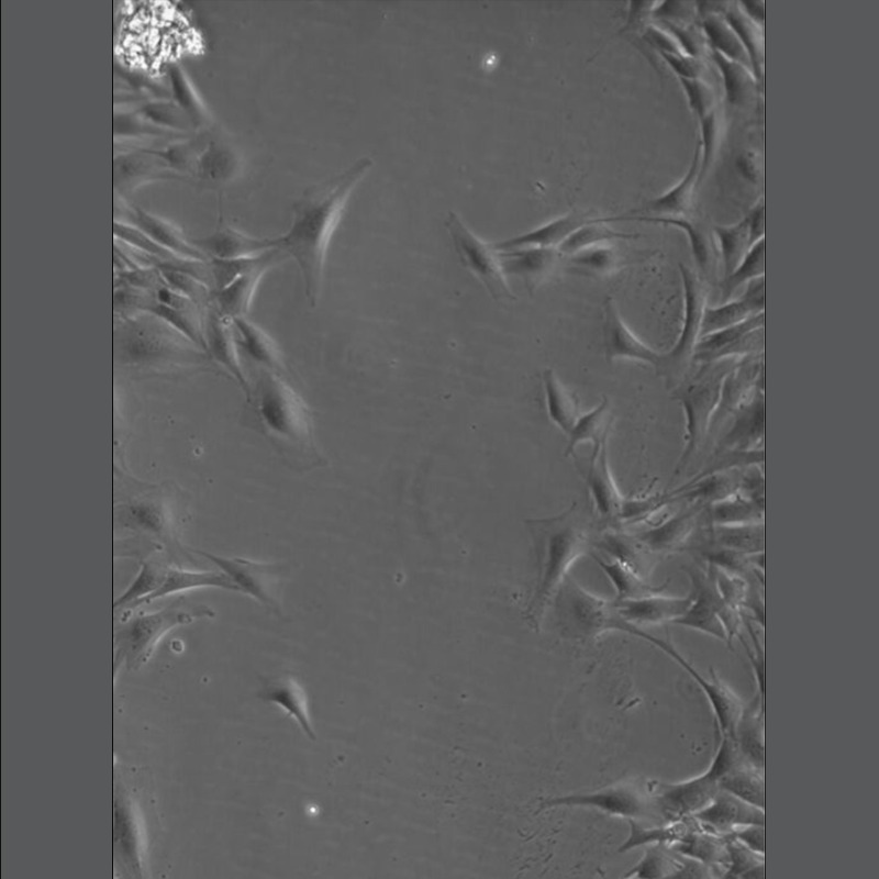 LeicaMicro's tweet photo. π° Read this #article to find out how wound healing of cultured smooth muscle cells (SMCs) in #multiwell plates can be investigated with less effort and reliably over time using a specially configured #DMi8 S inverted #microscope and on-stage #incubator.
β
Learn more!