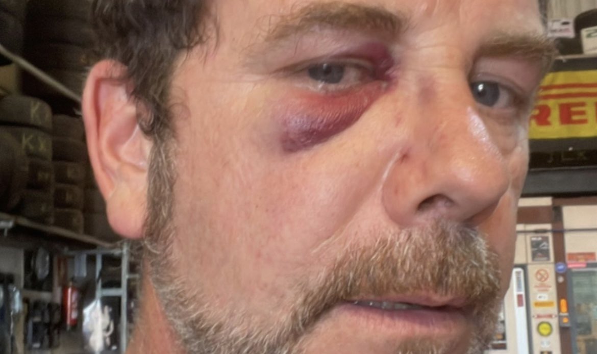 davidsantosvlog's tweet photo. Detienen a un magrebí de 18 años recién cumplidos en Estepona, por agredir a un hombre de 50 años y a sus sobrinos sin ningún motivo en plena calle. 

Son los niños de Teresa, que tienen como afición hacer estas travesuras. https://t.co/UqYYkgPWhY