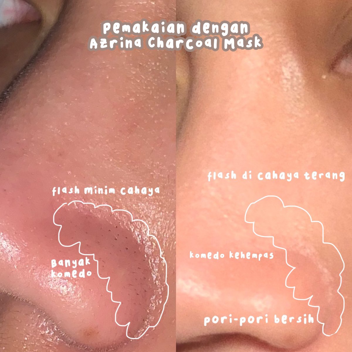 hmtly's tweet photo. Senengnya komedo ku hilang pakai Azrina Pure Charcoal Mask 😭👍

Gak bikin ketarik sama sekali di wajahku yang super kering, yang pastinya SANGAT MURAHH✨

( @AzrinaBeautyid )
• a review #racuninskincare ⤵️ https://t.co/nkykYIbAq6