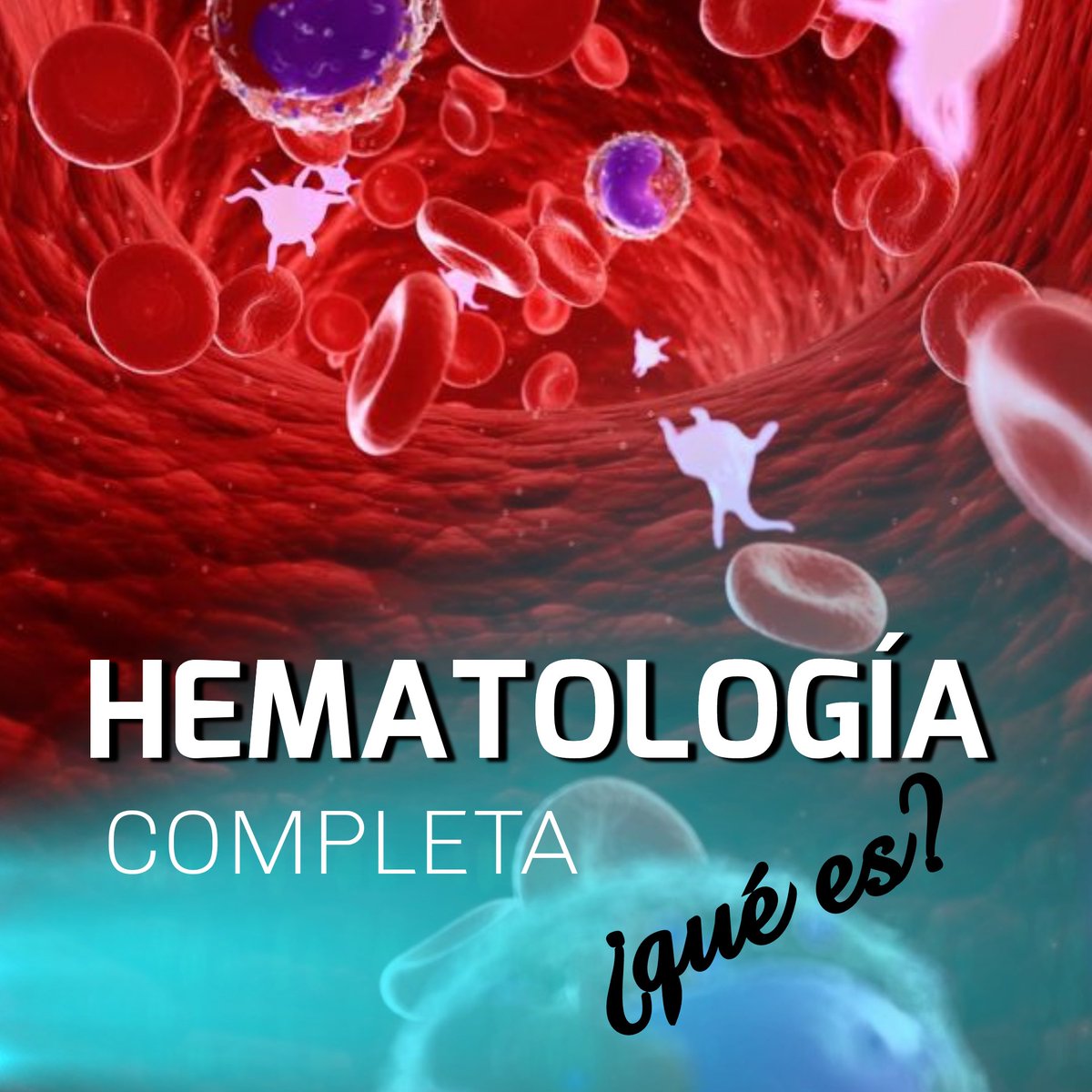 BiojobL's tweet image. Es un análisis de sangre que evalúa el estado de salud en general y detectar una amplia variedad de enfermedades, incluida la anemia, infecciones y leucemia, de ahí su importancia
#hematología #anemia #leucemia #puertolacruz #lecherías #barcelona #anzoátegui #anzoateguiteenamora