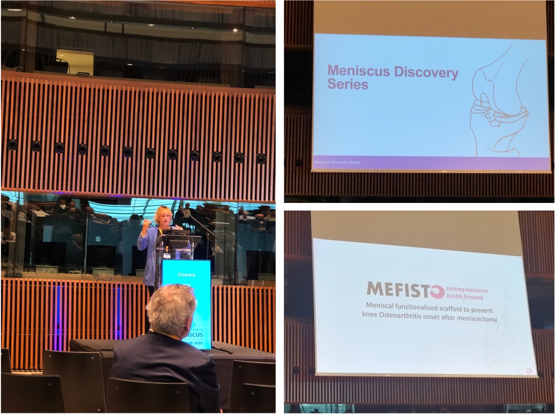 MEFISTO H2020 project (@mefisto_h2020) on Twitter photo E. Kon updated the audience about <a href="/MEFISTO_H2020/">MEFISTO H2020 project</a> at the Meniscus Conference in Luxembourg and announced the Meniscus Discovery Series: vimeo.com/682898062
J. Grammens spoke about what bone morphology can tell us about the future of the knee. E. Kon updated the audience about <a href="/MEFISTO_H2020/">MEFISTO H2020 project</a> at the Meniscus Conference in Luxembourg and announced the Meniscus Discovery Series: vimeo.com/682898062
J. Grammens spoke about what bone morphology can tell us about the future of the knee.