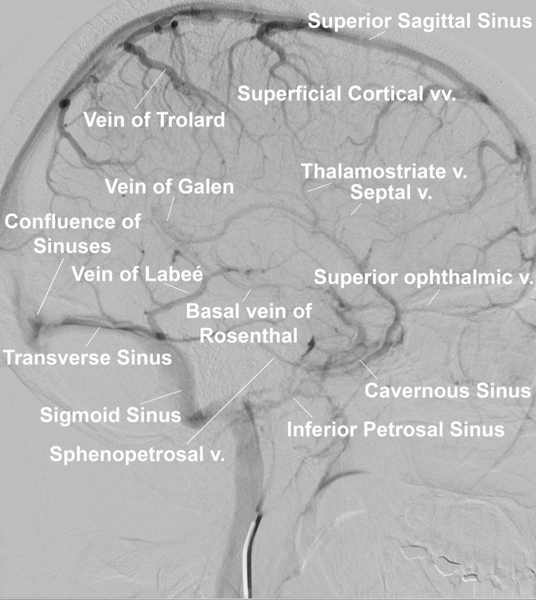 It's #factoidfriday and we're highlighting some cerebral venous system anatomy! #MedEd <a href="/SNISinfo/">SNIS Info</a> #NeuroIR #NeuroTwitter