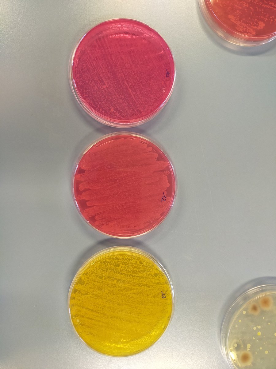 A Friday to discover we contain multitudes!!! Agar plates from hands🤚, nose👃 and mobile phones📱in the Jove Campus Recerca #jcr22 at @univgirona #UdGCampusEstiu @mirelops_ @PaoChiluizaR @GemmLab_UdG @IEA_UdG @LabMmi