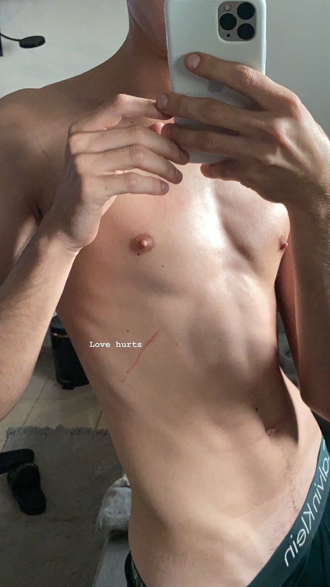 benhel4's tweet photo. Does ur love hurts? https://t.co/FA7EX61brM