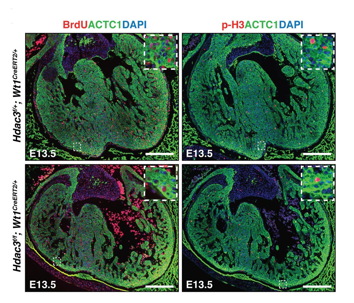 CircRes's tweet photo. Jang &amp; colleagues found that #Hdac3 in the developing #epicardium instructs compact #myocardium growth by inducing #Fgf9 &amp; #Igf2 transcription through repressing #miR322 &amp; #miR503. Learn more about mechanism at https://t.co/ZqgQH55MG0 
@Jihyunjang_JJ @Deqiang8 https://t.co/BaoZGrZLvP