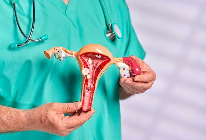Metropoles's tweet photo. O diagnóstico da doença é clínico, apesar de não ser tão simples detectá-la. Recorrer a exames de imagem é o método mais comum, como a ultrassonografia transvaginal e a ressonância magnética da pelve. https://t.co/9408tC1mBB