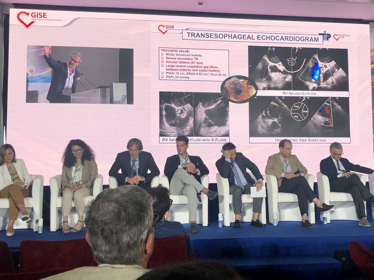 ABeneduceMD's tweet photo. 🎥Live in the box session📦on transcatheter #tricuspid therapy
@sicigise #GISETIP22🇮🇹
📍Patient evaluation #TriSCORE
📸Imaging assessment #echofirst
➡️Device selection #TEER
🔦Careful monitoring #TOE
@SRValveCenter @drmaisano @G_Tarantini01 @espogiov https://t.co/g3FYYxTpfE