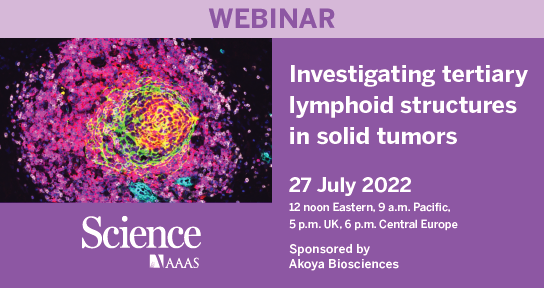 SciMagWebinars's tweet photo. Join #ScienceWebinars live on Weds, 27 July at 12p ET for:
Investigating tertiary lymphoid structures in solid tumors
Learn more and register for this free, educational broadcast at https://t.co/l9cymM4jET
#webinar #LymphoidStructures #CancerResearch https://t.co/vjawPfYI0P