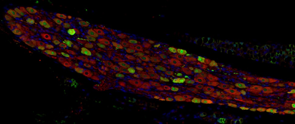 UtsWcand's tweet photo. The Bailey lab is looking for a postdoc to join our work on #aavvector #genetherapy for neurological disorders, with the goal of a Phase 1 clinical trial. https://t.co/YgJ9DbFyyT https://t.co/Fjun9I0sed