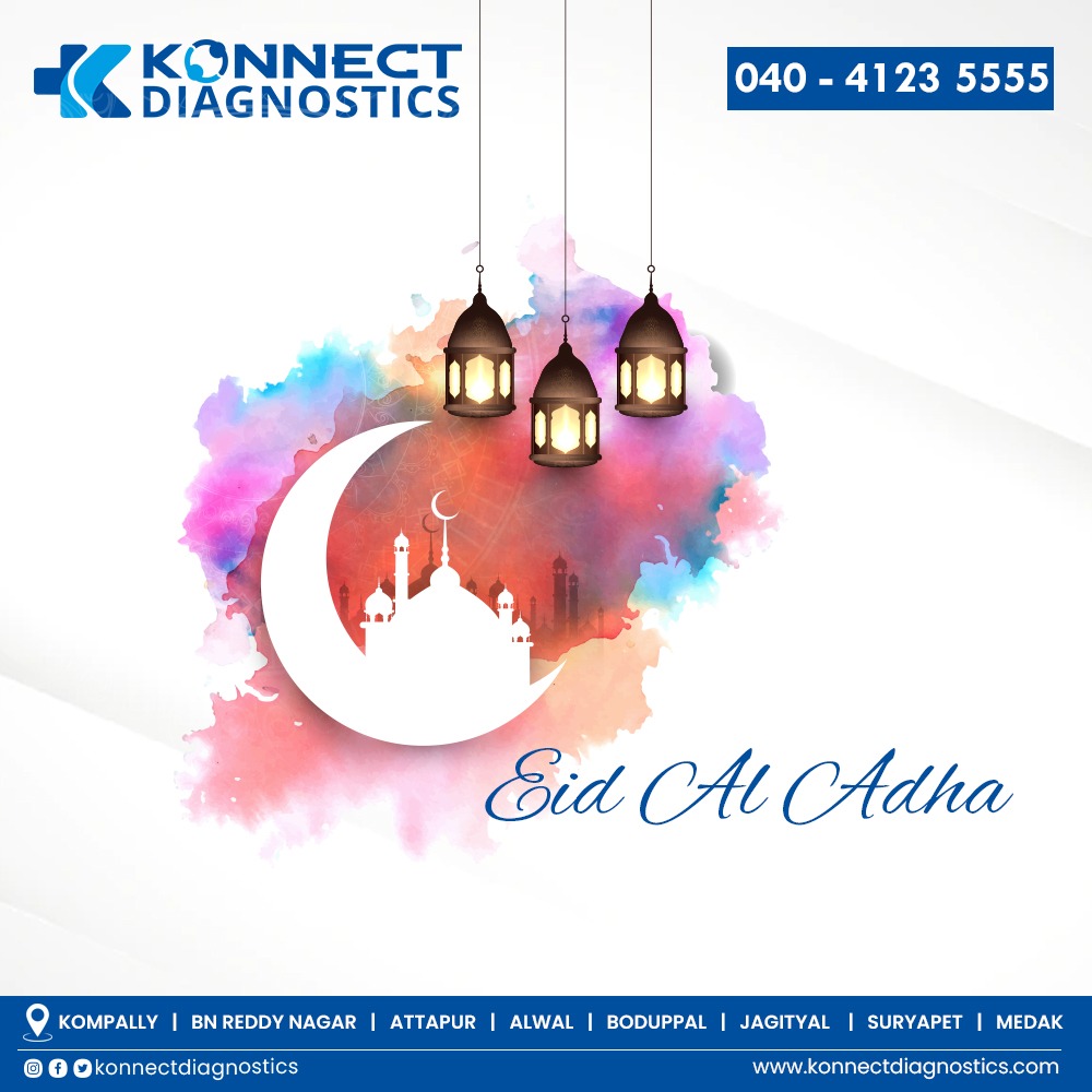 KonnectDiagnos2's tweet photo. EID AL ADHA Mubarak to All 
#eidaladha #konnectdiagnostics #diagnostics #diagnosticsinhyderabad #bakrid #konnect https://t.co/tpCdfmIPVf