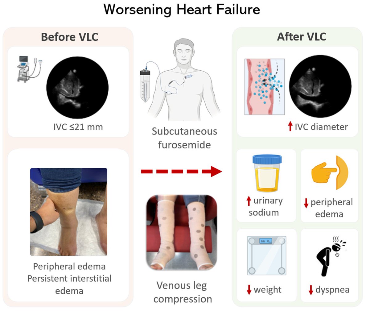 Venous Leg Compression in patients with WHF. This simple strategy promotes vascular refill and favors tissue decongestion frontiersin.org/articles/10.33…
