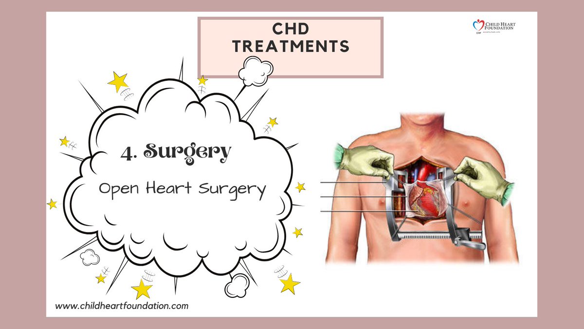 TREATMENT OPTION FOR CONGENITAL HEART DEFECT (CHD)🚨
CHECK OUT THE CREATIVE POSTER FOR VISUAL LEARNING.👇🏼
#chd #chdfacts #chdaware #chdcare4life #chdstrong #chdindia #chdvoice #1in100 #chdwarrior #chdfighter #chdtreatment #instaweekend