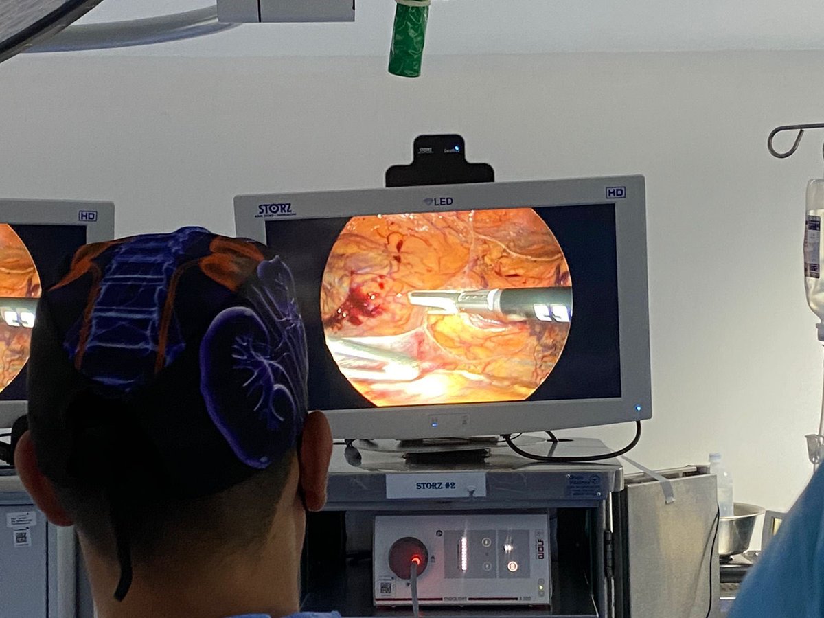 EIvanBravoC's tweet photo. En nuestro curso de mínima invasión no solo aprendimos #HoLEP también cirugía laparoscópica, robótica, biopsias de próstata TP, #Thulep, terapia focal, rezum y #MiniPCNL  gracias a todos nuestros invitados, organizadores y excelentes alumnos 👨‍🎓 #UroHCM https://t.co/c46KTMavMp