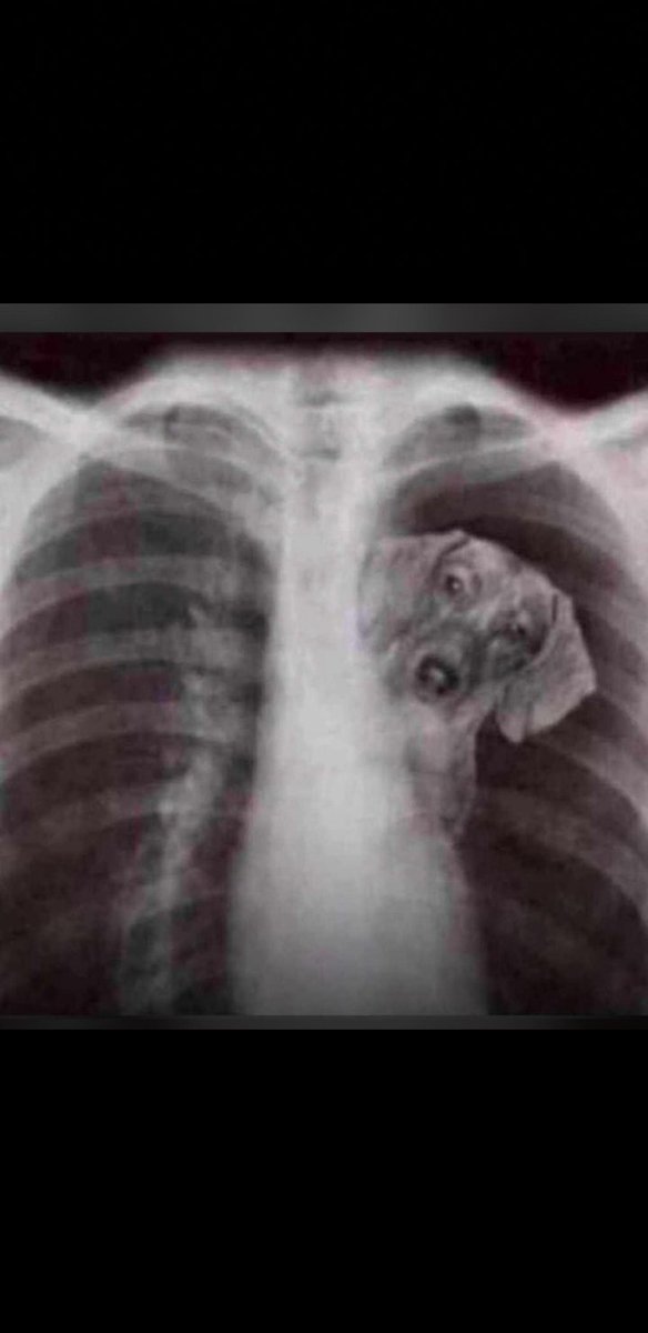 IvandroPilartes's tweet photo. Quando a "batalhadora da relação" decide ir fazer Raio X e, descobrem que só tem um "grande coração" porque é onde ela carrega o namorado/marido! 💔🙌🏾😅🤭🫢 https://t.co/2JEOTQF6vO