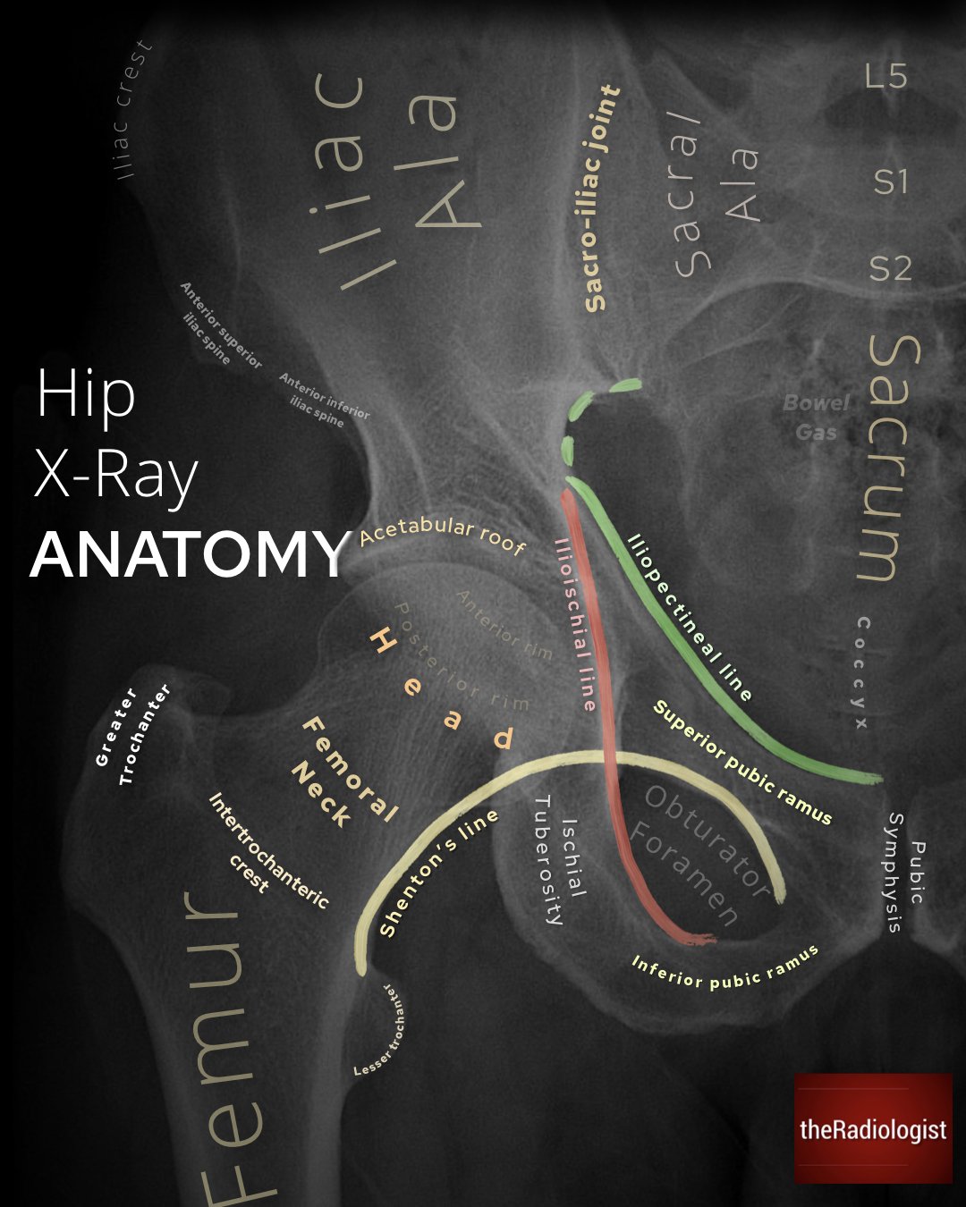 Kristin Sheaffer, MD (SheafferKristin) / Twitter