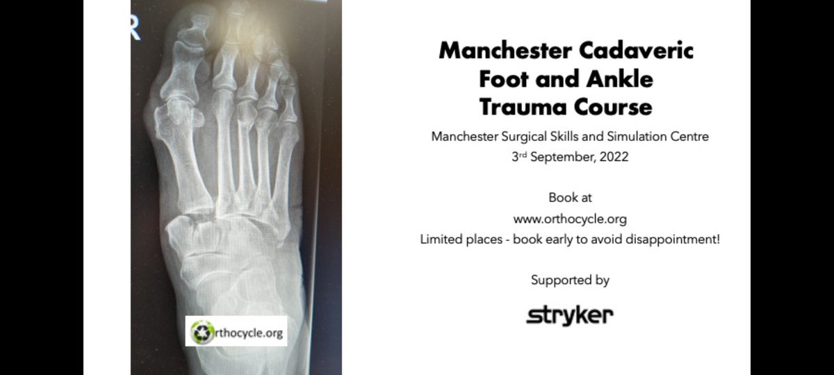 Orthocycle1's tweet photo. #Manchester #course on #footandankle #trauma #surgery on 3rd September by @Orthocycle1 
Book via https://t.co/bHkCHRiRy9
#cadaveric #training with great #faculty in modern #lab #variax #orthotwitter
@BritOrthopaedic @BritOrthAssoc @britishtrauma @BOFAS_UK @Stryker_TE @BritishORS https://t.co/vzt0mkVEUf
