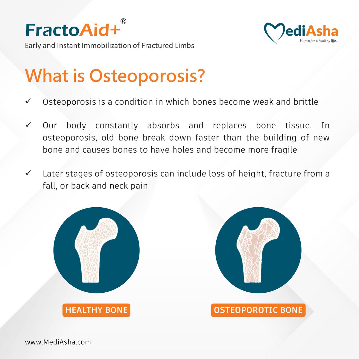 Most of us take our bones for granted, but bone health has real implications for our overall health.
Let’s know about #Osteoporosis, a bone disease that is severely impacting our health.
#mediasha #fractoaid #fracture #medicaldevice #doctor  #innovation #hospital  #healthcare