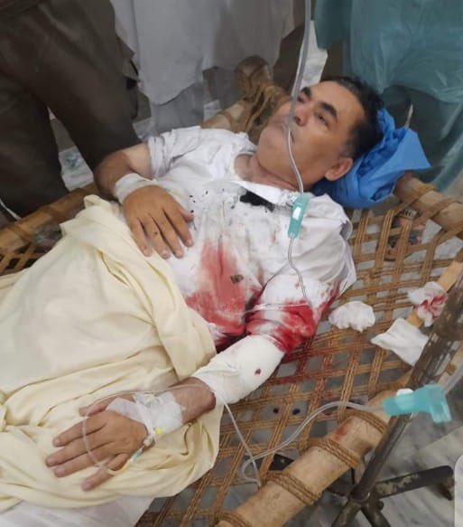 AsgharAchakzaii's tweet photo. اخترورځ دمبارکی،خوشحالی ده-ټول پښتون افغان مسلمان ملت ته دزړه له تله مبارکی واېم خوحقېقتً چی ګران افغانستان د ډېری لوئ ناقرارئ معاشی بدحالی اوپه لوي سرکي دغلامی سره مخامخ اودلته هم موږبحېثېت قام دترهګری ماوراءآئېن،قانون قېدوبنداوډېرونوروستنځوسره مخه ېو��وزکه اختردئ خوزړه ناخوښه دئ https://t.co/65KHA6MSzX
