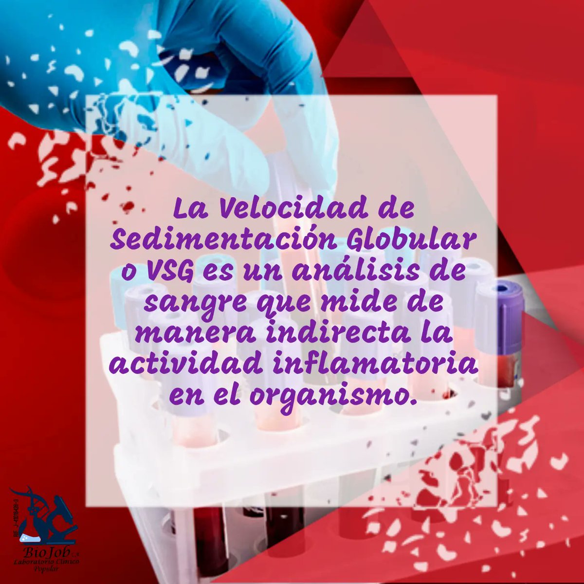 BiojobL's tweet image. Velocidad de Sedimentación Globular #PuertoLaCruz #PLC #Lecheria #Barcelona #guanta #Anzoátegui