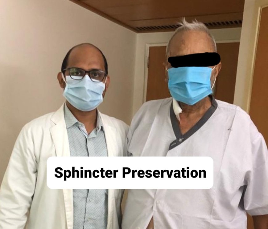 drsanjeev2003's tweet photo. #VeryLow #rectalcancer #roboticsurgery #sphincter #preservation 
A month of challenging cases.Very low rectal cancer, high BMI, male pelvis, post RT
Sphincter preservation,  intersphincteric resection, ultralow resecton
Use of  #davinci #Robotic surgery 
#GIcancer #PushingLimits https://t.co/CXAdryndXh