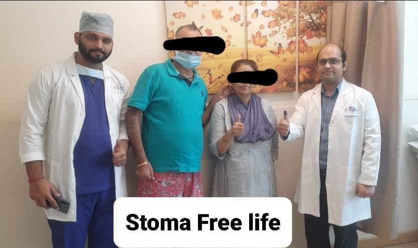 drsanjeev2003's tweet photo. #VeryLow #rectalcancer #roboticsurgery #sphincter #preservation 
A month of challenging cases.Very low rectal cancer, high BMI, male pelvis, post RT
Sphincter preservation,  intersphincteric resection, ultralow resecton
Use of  #davinci #Robotic surgery 
#GIcancer #PushingLimits https://t.co/CXAdryndXh