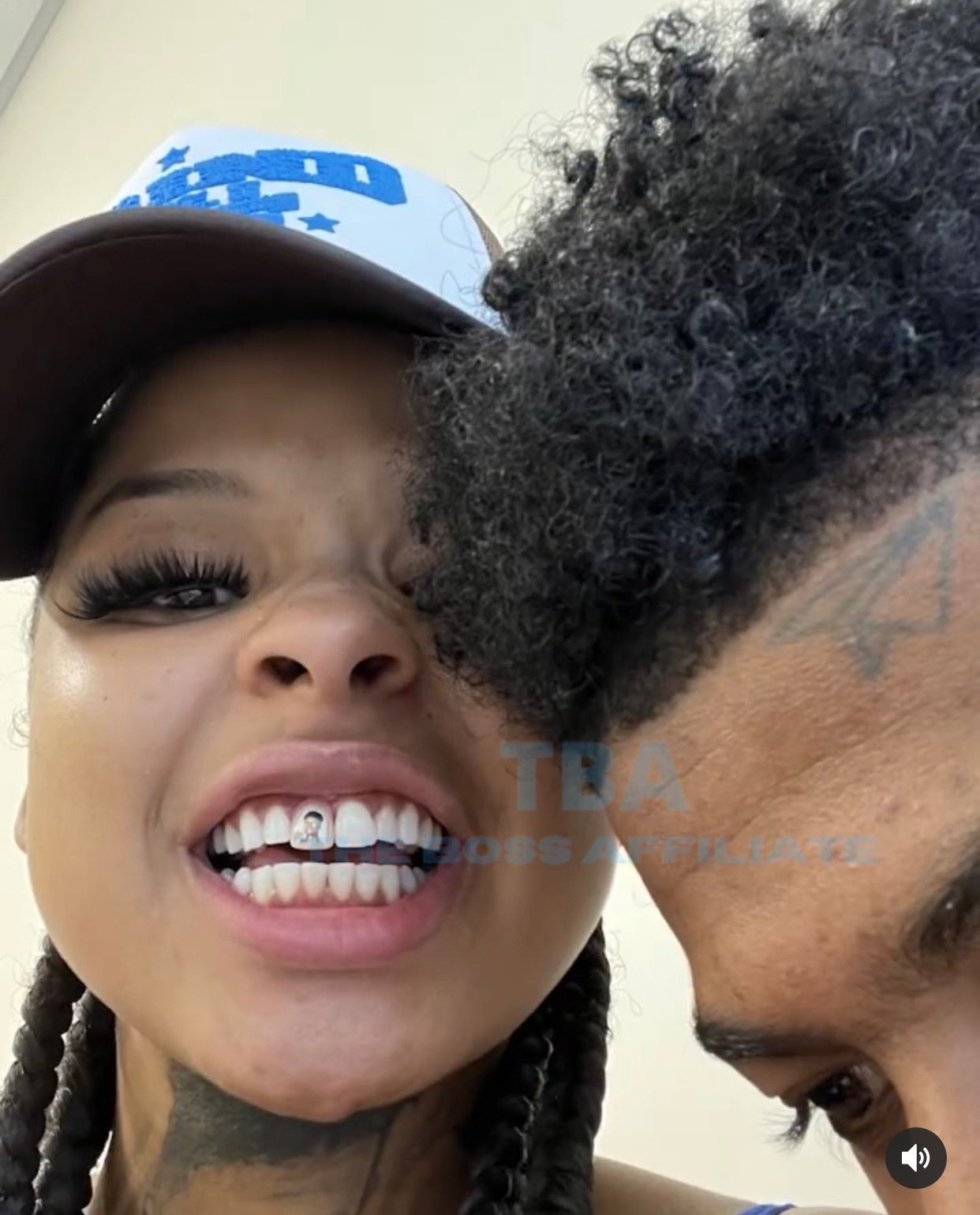 Blueface Girlfriend Tooth Tattoo 66 - wi92fcr