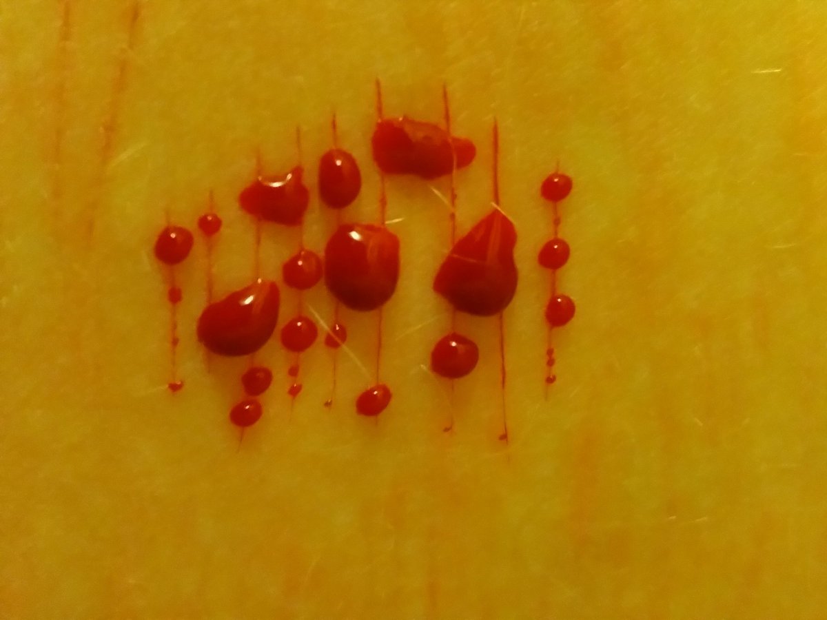 toxicblazers's tweet photo. ughh whyz it yellowww

shtwt bloodtwt styrotwt ouchietwt barcodetwt 198twt raspberryfillingtwt catscratchtwt sliceytwt yeettwt https://t.co/24gjvwCLpE