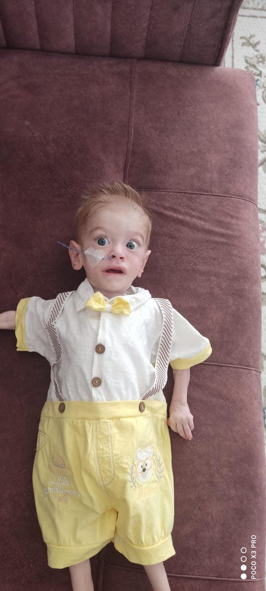 Müjde! Arden'imize sms ile bağış yapabileceğiniz hatlarımıza <a href="/Turkcell/">TURKCELL</a> de eklendi 🎉🎉🎉
ARDEN yazıp 3921'e gönderirseniz oğlumuza 10 TL değerinde bağış yapmış olacaksınız🧡🧡🧡🎉