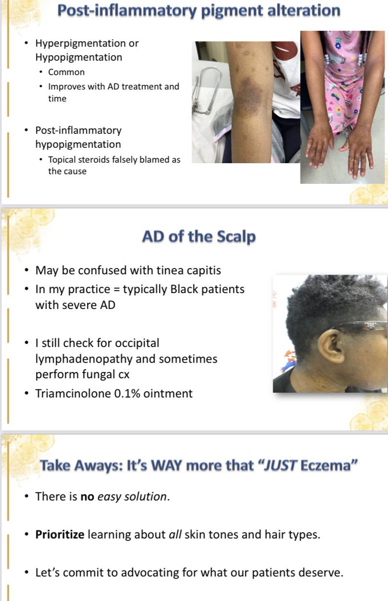 DrJanPeds's tweet photo. #SPD2022 presentation by @DrCandriceHeath on #Atopic #Dermatitis in #Skin of #Color
#TwitterDerm #Tweetiatrician #DEI #PutKids1st
#DrCandriceSays ⤵️ https://t.co/UXh74EMKuc