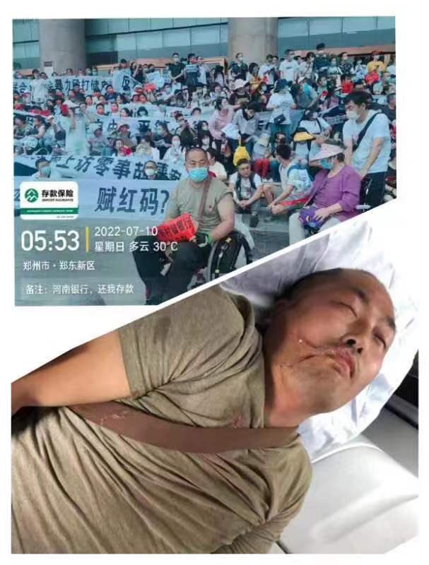 hk0257's tweet photo. The Chinese government has embezzled 40 billion deposits from ordinary people, plainclothes policemen have beaten ordinary people violently, imprisoned and restricted their personal freedom, the Chinese government is corrupt, and the Chinese society is dark! https://t.co/2t9z7sjcPk